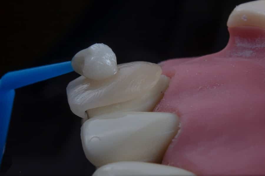 Photo Dent Removal